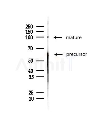 CD166 Antibody - Western blot analysis of lysates from MDA-MB-231 cells(heat-shock,45min treatment), using CD166 Antibody at 1/1000 dilution.