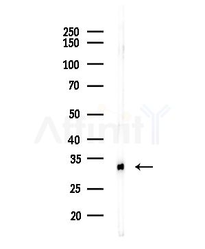 Bone Sialoprotein Antibody - Western blot analysis of lysates from COLO205 cells(heat-shock,45min treatment), using Bone Sialoprotein Antibody at 1/1000 dilution.