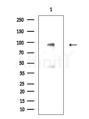 GLIS3 Antibody - Western blot analysis of extracts from Hela cells, using GLIS3 Antibody at 1/1000 dilution.