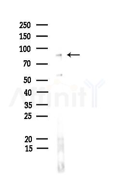 GLIS3 Antibody - Western blot analysis of lysates from Hela cells, using GLIS3 Antibody at 1/1000 dilution.