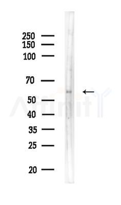 ZKSCAN3 Antibody - Western blot analysis of lysates from EC304 cells, using ZKSCAN3 Antibody at 1/1000 dilution.