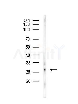 SOD3 Antibody - Western blot analysis of lysates from HUVEC cells(LPC4h treatment), using SOD3 Antibody at 1/1000 dilution.