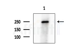 Nestin Antibody - Western blot analysis of extracts from HUVEC cells, using Nestin Antibody at 1/1000 dilution.