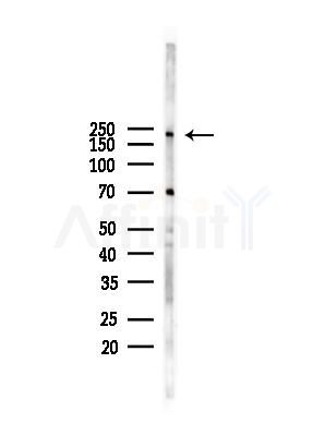 Nestin Antibody - Western blot analysis of lysates from HUVEC cells, using Nestin Antibody at 1/1000 dilution.