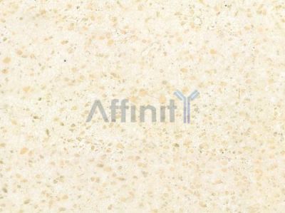SIAH2 Antibody - DF7767 at 1/100 staining human astrocytoma by IHC-P.