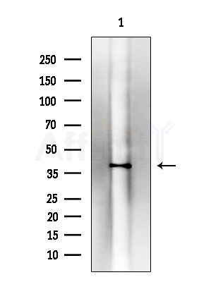 Phospho-MKK7 (Thr275)  Antibody - Western blot analysis of lysates from EC304 cells, using Phospho-MKK7 (Thr275)  Antibody at 1/1000 dilution.