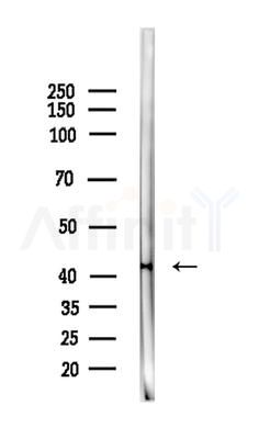Phospho-MKK7 (Thr275)  Antibody - Western blot analysis of lysates from EC304 cells, using Phospho-MKK7 (Thr275)  Antibody at 1/1000 dilution.