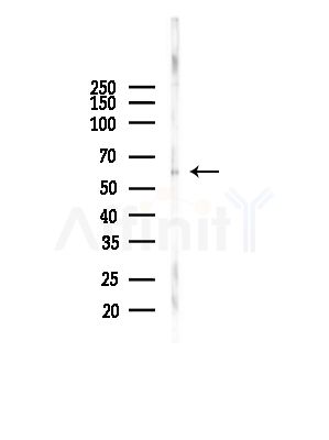 Phospho-PKM2 (Ser37) Antibody - Western blot analysis of lysates from COLO205 cells(UV,30min treatment), using Phospho-PKM2 (Ser37) Antibody at 1/1000 dilution.