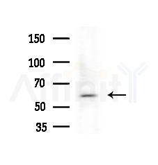 Cytokeratin 6a Antibody - Western blot analysis of extracts from HepG2 cells(LPS,4h treatment), using Cytokeratin 6a Antibody at 1/1000 dilution.
