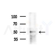 Cytokeratin 6a Antibody - Western blot analysis of extracts from COLO205 cells(heat-shock,45min treatment), using Cytokeratin 6a Antibody at 1/1000 dilution.