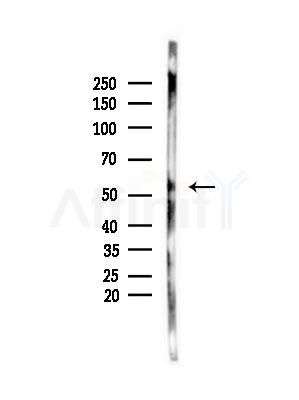 Cytokeratin 6a Antibody - Western blot analysis of lysates from COLO205 cells(heat-shock,45min treatment), using Cytokeratin 6a Antibody at 1/1000 dilution.