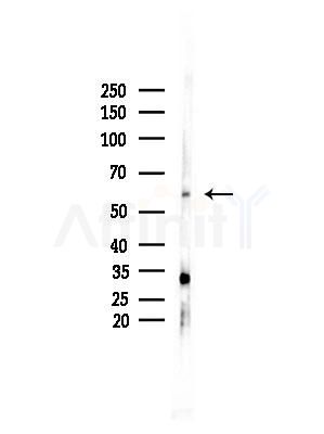 Cytokeratin 6a Antibody - Western blot analysis of lysates from HepG2 cells(LPS, 4h treatment), using Cytokeratin 6a Antibody at 1/1000 dilution.