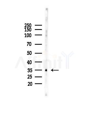 HSD17B1 Antibody - Western blot analysis of lysates from HUVEC cells, using HSD17B1 Antibody at 1/1000 dilution.