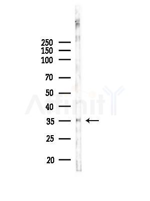HSD17B1 Antibody - Western blot analysis of lysates from EC304 cells, using HSD17B1 Antibody at 1/1000 dilution.