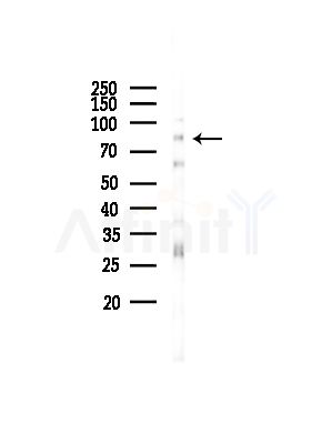 DAB2 Antibody - Western blot analysis of lysates from Rat liver, using DAB2 Antibody at 1/1000 dilution.