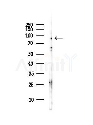DAB2 Antibody - Western blot analysis of lysates from Mouse lung, using DAB2 Antibody at 1/1000 dilution.