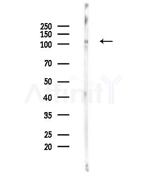 KSR1 Antibody - Western blot analysis of lysates from Hela cells(UV,30min treatment), using KSR1 Antibody at 1/1000 dilution.