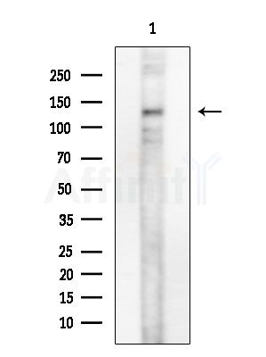 SYNJ2 Antibody - Western blot analysis of extracts from Rat testis, using SYNJ2 Antibody at 1/1000 dilution.