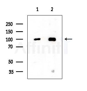 ACTN2 Antibody - Western blot analysis of extracts from various samples, using ACTN2 Antibody at 1/1000 dilution.