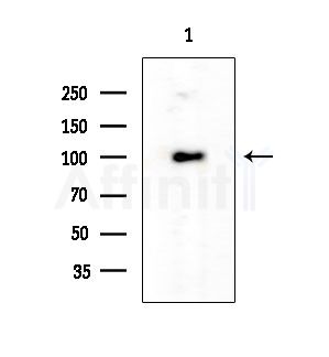 ACTN2 Antibody - Western blot analysis of extracts from Mouse liver, using ACTN2 Antibody at 1/1000 dilution.