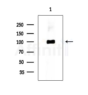 ACTN2 Antibody - Western blot analysis of extracts from Rat testis, using ACTN2 Antibody at 1/1000 dilution.