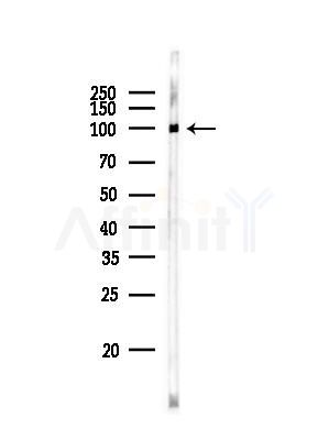 ACTN2 Antibody - Western blot analysis of lysates from Rat testis, using ACTN2 Antibody at 1/1000 dilution.