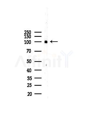 ACTN2 Antibody - Western blot analysis of lysates from HUVEC cells, using ACTN2 Antibody at 1/1000 dilution.