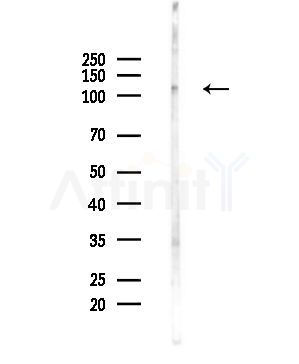 PLD1 Antibody - Western blot analysis of lysates from Hela cells(UV,30min treatment), using PLD1 Antibody at 1/1000 dilution.