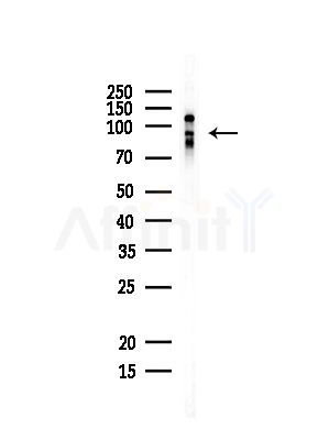HNRNPUL1 Antibody - Western blot analysis of lysates from Rat liver, using HNRNPUL1 Antibody at 1/1000 dilution.