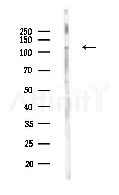 FYB Antibody - Western blot analysis of lysates from HepG2 cells(heat-shock,45min treatment), using FYB Antibody at 1/1000 dilution.