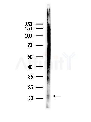 TNFSF4 Antibody - Western blot analysis of lysates from MDA-MB-231 cells(heat-shock,45min treatment), using TNFSF4 Antibody at 1/1000 dilution.