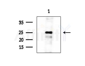 HMGB3 Antibody - Western blot analysis of extracts from EC304 cells, using HMGB3 Antibody at 1/1000 dilution.