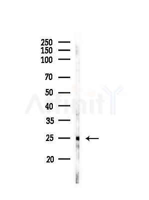 HMGB3 Antibody - Western blot analysis of lysates from EC304 cells, using HMGB3 Antibody at 1/1000 dilution.