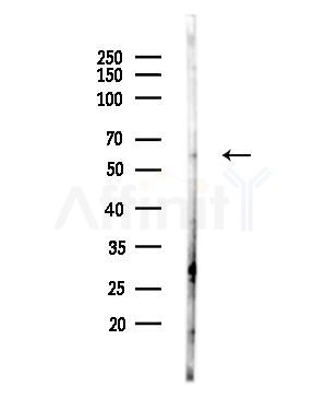 CDC6 Antibody - Western blot analysis of lysates from MDA-MB-231 cells, using CDC6 Antibody at 1/1000 dilution.
