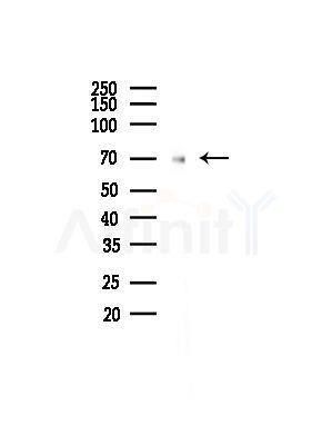 CTNNBL1 Antibody - Western blot analysis of lysates from COLO205 cells(UV,30min treatment), using CTNNBL1 Antibody at 1/1000 dilution.
