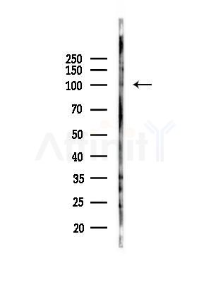APBB1IP Antibody - Western blot analysis of lysates from HepG2 cells(LPS, 4h treatment), using APBB1IP Antibody at 1/1000 dilution.