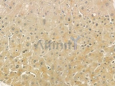 LRP6 Antibody - DF7837 at 1/100 staining human normal liver tissue by IHC-P.