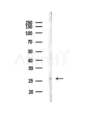 C1QA Antibody - Western blot analysis of lysates from Mouse brain, using C1QA Antibody at 1/1000 dilution.