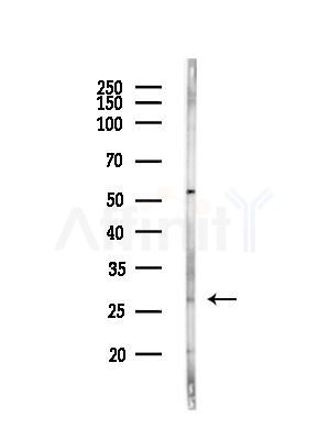 C1QA Antibody - Western blot analysis of lysates from HepG2 cells(heat-shock,45min treatment), using C1QA Antibody at 1/1000 dilution.