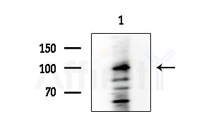 Band 3/AE 1 Antibody - Western blot analysis of extracts from EC304 cells, using Band 3/AE 1 Antibody at 1/1000 dilution.