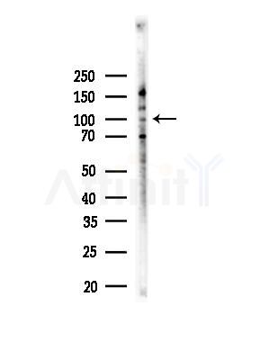 Band 3/AE 1 Antibody - Western blot analysis of lysates from EC304 cells, using Band 3/AE 1 Antibody at 1/1000 dilution.