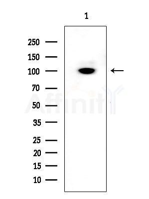 CUL4B Antibody - Western blot analysis of extracts from EC304 cells, using CUL4B Antibody at 1/1000 dilution.