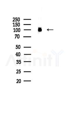 CUL4B Antibody - Western blot analysis of lysates from HUVEC cells, using CUL4B Antibody at 1/1000 dilution.