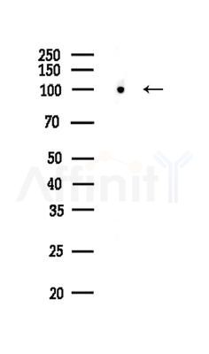 CUL4B Antibody - Western blot analysis of lysates from EC304 cells, using CUL4B Antibody at 1/1000 dilution.