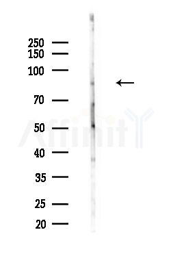 F13A1 Antibody - Western blot analysis of lysates from B16F10-LUC cells(heat-shock,45min treatment), using F13A1 Antibody at 1/1000 dilution.