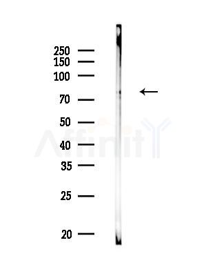 SYN2 Antibody - Western blot analysis of lysates from Rat brain, using SYN2 Antibody at 1/1000 dilution.