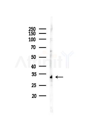 NDUFAF1 Antibody - Western blot analysis of lysates from RAW264.