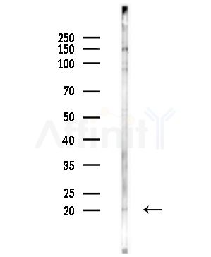 AP2S1 Antibody - Western blot analysis of lysates from Hela cells(UV,30min treatment), using AP2S1 Antibody at 1/1000 dilution.