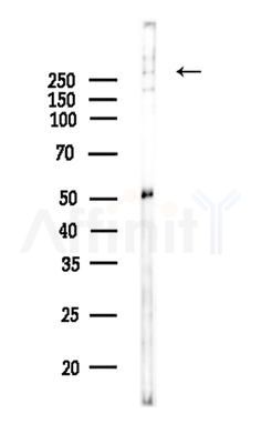 Thyroglobulin Antibody - Western blot analysis of lysates from 3T3-L1 P6(LPS,4h treatment), using Thyroglobulin Antibody at 1/1000 dilution.