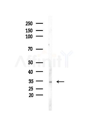SULT1A3 Antibody - Western blot analysis of lysates from Mouse brain, using SULT1A3 Antibody at 1/1000 dilution.